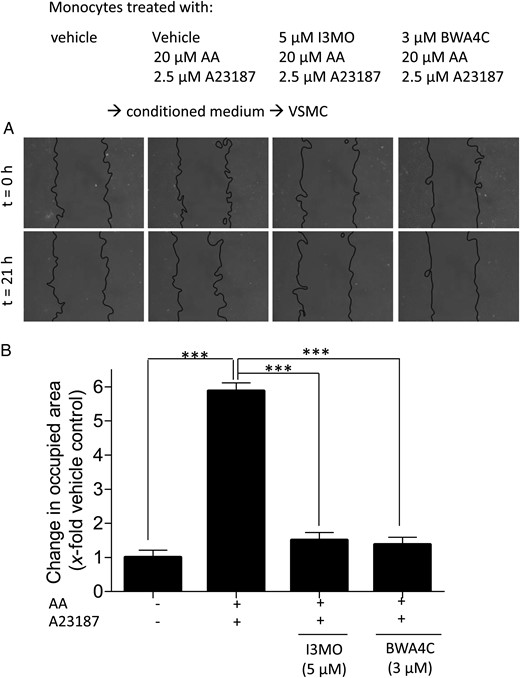 Incubation of monocytes with I3MO or BWA4C prevents VSMC migration induced by conditioned medium from activated monocytes. VSMCs were stimulated for 21 h in a wound healing assay with conditioned medium from monocytes that were pre-incubated with vehicle, I3MO, and BWA4C for 15 min and then stimulated for 10 min with AA (20 µM) + A23187, as indicated. (A) Photos of the ‘wound’ in the VSMC monolayer at the beginning (t = 0 h) and the end (t = 21 h) of stimulation period (light microscopy, magnification ×100). (B) Graph indicating the change in area occupied by cells as fold induction of VSMC migration from three independent biological replicates with four technical replicates each; mean + SE; ***P < 0.001.