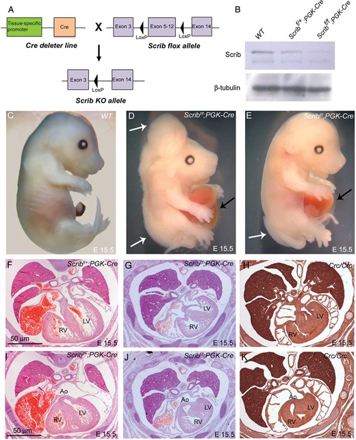 Cardiac anomalies in Scribf/f;PGK-Cre embryos. (A) Schematic representation of breeding strategy to obtain Scrib-deleted mice. (B) Western blotting (n = 3) showed that Scrib protein levels were markedly reduced in Scribf/f;PGK-Cre at E15.5. β-Tubulin was used as a loading control. (C–E) Scribf/f;PGK-Cre embryos display neural tube defects (white arrows) and gastroschisis (black arrows) at E14.5. (F and I) Scribf/+;PGK-Cre have normal hearts. (G and J) Scribf/f;PGK-Cre exhibit double outlet right ventricle, ventricular septal defects, and septal hyperplasia that closely resemble those seen in Crc/Crc (H and K). See Table 1 for numbers of animals analysed. Ao, aorta; LV, left ventricle; RV, right ventricle. Scale bar = 50 μm.
