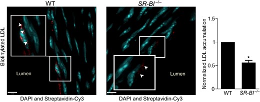 Deficiency of SR-BI reduces LDL transcytosis ex vivo. Aortas from SR-BI-deficient mice and wild-type (WT) littermates were perfused ex vivo with biotinylated LDL (25 µg/mL). Serial sections were stained with streptavidin-Cy3, and z-stack images were then acquired by confocal microscopy under identical microscope settings. Nuclei are stained with DAPI (blue). All perfusion, sectioning, staining, and image analysis were performed as four separate experiments, each containing one WT and one SR-BI−/− mouse. Images were quantified using ImageJ for Cy3 (red) fluorescence; all signal above background was measured. For each experiment, the same background correction was applied to images from both the knockout and matching wild-type aorta. Results are presented as the red fluorescence intensity in a SR-BI−/− aorta normalized to its WT equivalent. More punctae of LDL are visible in WT vs. SR-BI−/− vessels (inset, arrowheads). Quantification is shown at right. *P < 0.01 by one-sample t-test, four mice per group.