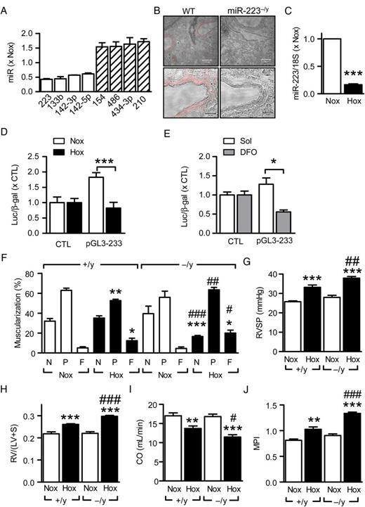  Hypoxia-induced regulation of miR-223 in the mouse lung. ( A ) MicroRNAs in murine lung most significantly altered by hypoxia (10% O 2 , 21 days) vs. normoxia (Nox); n = 4 per group. ( B ) Representative in situ hybridizations showing miR-223 (red) expression in wild-type (WT, +/y) and miR-223 −/y (−/y) lungs; bar = 100 µm (upper panels) and 20 µm (lower panels). ( C ) RT–qPCR analysis of miR-223 expression in normoxic and hypoxic (Hox) mouse lungs; three independent experiments with at least four mice per group and experiment; *** P <0.001, t -test. ( D ) Effect of normoxia (Nox) vs. hypoxia (Hox, 1% O 2 ) on miR-223 promoter activity in COS-7 cells; n = 4. ( E ) Effect of chemical hypoxia (i.e. deferoxamine; DFO; 130 µmol/L, 48 h) on miR-223 core promoter activity in COS-7 cells; n = 4. ( F ) Effect of hypoxia (Hox) on pulmonary artery (20–70 µm) remodelling in mouse lungs from +/y and −/y littermates, N = non-muscularized; P = partially muscularized; F = fully muscularized ( n = 5–8). ( G ) Effect of hypoxia on right-ventricular systolic pressure (RVSP) in +/y and −/y littermates ( n = 5–14). ( H ) Effect of hypoxia on right-ventricular hypertrophy (RV/(LV+S)) in +/y and −/y littermates ( n = 5–14). ( I and J ) Effect of hypoxia on right-ventricular function in wild-type (+/y) and miR-223 −/y littermates ( n = 7–9); ( I ) cardiac output (CO, mL/min) and ( J ) myocardial performance index (MPI). * P <0.05, ** P < 0.01, *** P <0.001 vs. Nox; #P <0.05, ##P <0.01, ###P <0.001 vs. +/y, ANOVA (Newman–Keuls). 