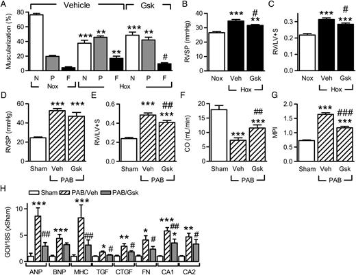  Consequences of IGF-IR inhibition on pulmonary vascular remodelling and right heart function. ( A ) Effect of IGF-IR inhibition on pulmonary vascular muscularization (20–70 μm vessels) in hypoxic (Hox; 10% O 2 , 21 days) mice treated with vehicle (Veh) or GSK1904529A (Gsk; 30 mg/kg p.o.) from Day 7. N = non-muscularized; P = partially muscularized; F = fully muscularized ( n = 5–7). ( B and C ) Effect of IGF-IR inhibition in hypoxia on ( B ) RV systolic pressure (RVSP) and ( C ) right-ventricular hypertrophy (RV/LV+S), ( n = 5–10). ( D–G ) Effect of GSK1904529A on right heart hypertrophy and function following pulmonary artery banding (PAB); ( D ) RVSP, ( E ) RV/LV+S, ( F ) CO, and ( G ) MPI ( n = 5–10). ( H ) Effect of GSK1904529A on the expression of hypertrophy- and fibrosis-related genes of interest (GOI) in animals subjected to PAB ( n = 5). * P <0.05, ** P <0.01, *** P <0.001 vs. Nox or sham; #P <0.05, ##P <0.01, ###P <0.001 vs. Hox/Veh or PAB/Veh, ANOVA (Newman–Keuls). 
