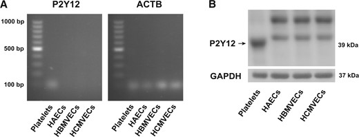 Presence of P2Y12 receptor in human platelets but not in endothelial cells. (A) P2Y12 RNA in human platelets compared with HAECs, HBMVECs and HCMVECs (n = 3). (B) Protein expression of the P2Y12 receptor in human platelets, compared with HAECs, HBMVECs, or HCMVECs (n = 3). ACTB, human β-actin; GAPDH, glyceraldehyde 3-phosphate dehydrogenase; HAECs, human aortic endothelial cells; HBMVECs, human brain microvascular endothelial cells; HCMVECs, human cardiac microvascular endothelial cells.