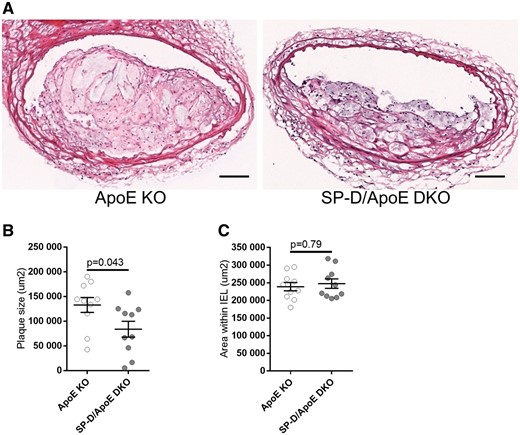 SP-D deficiency in ApoE KO mice reduces atherosclerotic plaque size in brachiocephalic arteries. (A) H&E staining of representative brachiocephalic arteries of ApoE KO and SP-D/ApoE DKO mice after 12 weeks of high-fat diet. Quantification of (B) atherosclerotic plaque size within the brachiocephalic artery, and (C) area within the internal elastic lamina (IEL) of the brachiocephalic artery. Five sections through the brachiocephalic artery (equally spaced at 200 um intervals) were evaluated, and the results were averaged for each animal. n = 10 for each group. Data represent mean ± SEM. P values were calculated using the Mann–Whitney U test. Scale bars: 100 μm.