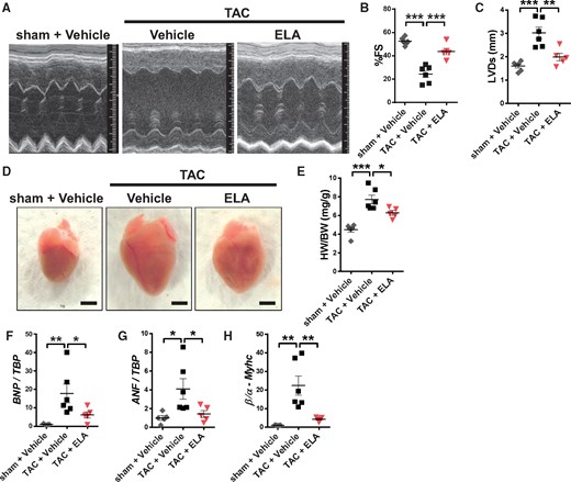 ELA protects from pressure overload-induced heart failure in wild type mice. (A–C) Echocardiography measurements of wild type mice under sham operation (n = 6) or TAC treated with either vehicle (n = 6) or ELA (n = 5). Representative M-mode echocardiography images (A), measurements of %fractional shortening (B) and LVESD (C). (D–H) ELA rescued cardiac hypertrophy induced by TAC in mice. Representative photograph (D) of the hearts of mice under TAC. Bars indicate 2 mm. (E) Heart weight to body weight ratio (E). (F–H) qRT-PCR analysis of mRNA levels of B-type natriuretic peptide (BNP) (F), Atrial natriuretic factor (ANF) (G), and β-myosin heavy chain (βMyhc) (H) in the hearts under sham operation (n = 5) or TAC treated with either vehicle (n = 6) or ELA (n = 5). Data were normalized with TATA-box binding protein (TBP) (F, G) or α-myosin heavy chain (αMyhc) (H). All values are means ± SEM. n.s. not significant, *P < 0.05, **P < 0.01, ***P < 0.001, the data were analyzed with one-way ANOVA and Turkey’s post-hoc test.