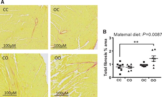 Male offspring exposed to maternal obesity develop signs of cardiac fibrosis. (A) Representative images of ventricular mid-cardiac sections (10 µm) stained with Picrosirius Red. Areas positive for fibrosis were stained red; (B) quantification of total fibrosis expressed as a percentage of tissue area. CC, mum fed chow, offspring fed chow; OC, mum fed obesogenic diet, offspring fed chow; CO, mum fed chow, offspring fed obesogenic diet; OO, mum fed obesogenic diet, offspring fed obesogenic diet. Data are presented as means ± SEM (n = 6–8 from independent litters for each dietary group) and were analysed by two-way ANOVA. Dunnett’s multiple comparisons test was performed to evaluate significant differences to the CC group: **P < 0.01.