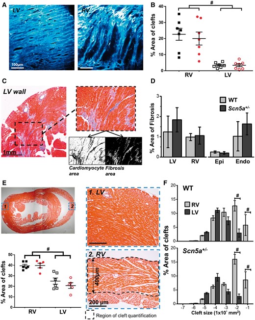 Transmural structural features in mouse LV and RV. (A) Example images of cardiomyocyte density from 2 P imaging of LV (left) and RV (right) sub-epicardium (z-100 μm). (B) Quantification of non-vascular clefts from 2 P images, in WT (black squares, n = 7) and Scn5a+/− (red circles, n = 7) hearts. (C) Fibrosis quantification from histological section stained with Masson’s trichrome. Fibrosis is shown in blue. Black and white images below inset image show quantification of cardiomyocyte (left) and fibrosis (right) area using thresholding in ImageJ. (D) Left panel—% area of fibrosis from the transmural wall for both LV and RV. Right panel—% area of fibrosis measured from the LV sub-epicardium (from surface to deepest scan depth using 2P microscope) and the midmyocardium to sub-endocardium (portion of ventricle not scanned using two-photon). A total of eight serial sections were quantified for each heart and a single mean value obtained from these values. (E) Top left image shows a histological section stained with Masson’s trichrome, images on right indicate typical sections from 1. LV and 2. RV transmural wall. Absolute depth of quantification for both LV and RV is indicated in 2. Bottom left panel indicates quantification of non-vascular clefts in both ventricles from histological sections of WT (black squares, n = 6) and Scn5a+/− (red circles, n = 5) hearts. (F) Comparison of graded cleft sizes as a percentage of total cleft area between RV (light grey) and LV (dark grey). Top panel; WT mouse hearts (n = 6), bottom panel; Scn5a+/− mouse hearts (n = 5). Panels B, E, and F, #P < 0.01, RV vs. LV. Two-way ANOVA with Bonferroni multiple comparisons test.