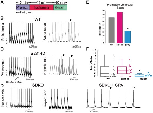 PLN ablation rescues the reperfusion ventricular arrhythmias produced by CaMKII-dependent phosphorylation of RyR2 at the S2814 site in the intact heart. (A) Schematic representation of I/R protocol. (B–D) Representative action potential tracings during pre-ischaemia (left) and at the onset of reperfusion (right), in WT (B), S2814D (C), SDKO, and SDKO hearts in the absence and presence of CPA (D). Arrow in C indicates electrical stimulus artefact on AP recording with microelectrodes. Arrowheads in C and D indicate premature beats. (E and F) Premature ventricular beat incidence and frequency (box plot), respectively. Categorical data (E), expressed as percentages, were compared with Fisher’s exact test. Non-parametric data (F) were compared with the Kruskal–Wallis test. A P-value <0.05 was considered significant. *P < 0.05 vs. WT and S2814D mice. N = 9–17 hearts in the different groups.