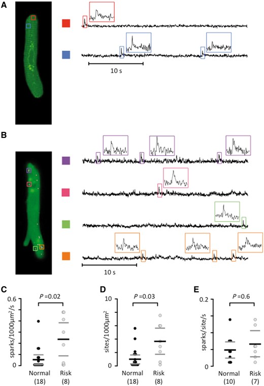The rs13143308T risk variant increases the calcium spark density. (A) Longitudinal plane of a human atrial myocyte from a patient without a 4q25 risk variant, with indication of two spark sites on the left (colored rectangles). Calcium signals are shown for each spark site on the right. Insets show calcium signals for individual sparks. (B) Sparks in a human atrial myocyte from a patient with a 4q25 risk variant. (C) Spark frequency. (D) Spark sites per cell. (E) Spark firing frequency. P-values from the unpaired t-tests (E) or Mann–Whitney tests (C and D) are given above data points and the number of patients in parentheses.