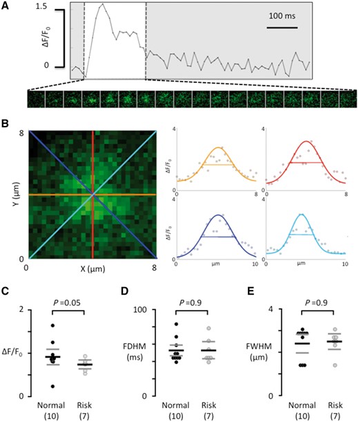 Calcium spark properties do not depend on the genotype at rs13143308. (A) Ca2+ transient from a single spark site. Consecutive 8 × 8 μm images of the calcium spark are shown below the Ca2+ transient during its rise and decay (white window area). (B) Enlarged image of the calcium spark in A, recorded at its maximal amplitude. The profile of the calcium spark is shown on the right for each of the four coloured axes outlined in the image on the left. The width of the calcium spark at half maximum was calculated as the average of the four axes. (C) Calcium spark amplitude. (D) Calcium spark duration at half maximum. (E) Width of the calcium spark at half maximum. Values are from the same myocytes as in Figure 2. P-values for the unpaired t-tests (C) or Mann–Whitney tests (D and E) are given above data points and the number of patients is given in parentheses.