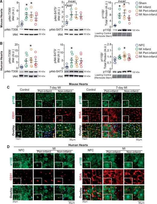 Catalytic isoform of PI3Kβ-p110β is increased in post-MI murine and human hearts and expressed both in ECs and CMs. (A and B) Western blot analysis of Akt and p110β levels on 7-day post-sham/MI mouse hearts and on non-failing control (NFC) and post-MI failing human hearts. *P < 0.05 vs. sham/NFC hearts, n = 3–6 hearts/group (one-way ANOVA). (C and D) Immunofluorescence images of p110β (green) in the heart with EC marker-CD31 (red, left panels), WGA outlining CMs (red, right panels), and DAPI marking nuclei (blue) on mouse and human hearts, n = 3–4 hearts/group.