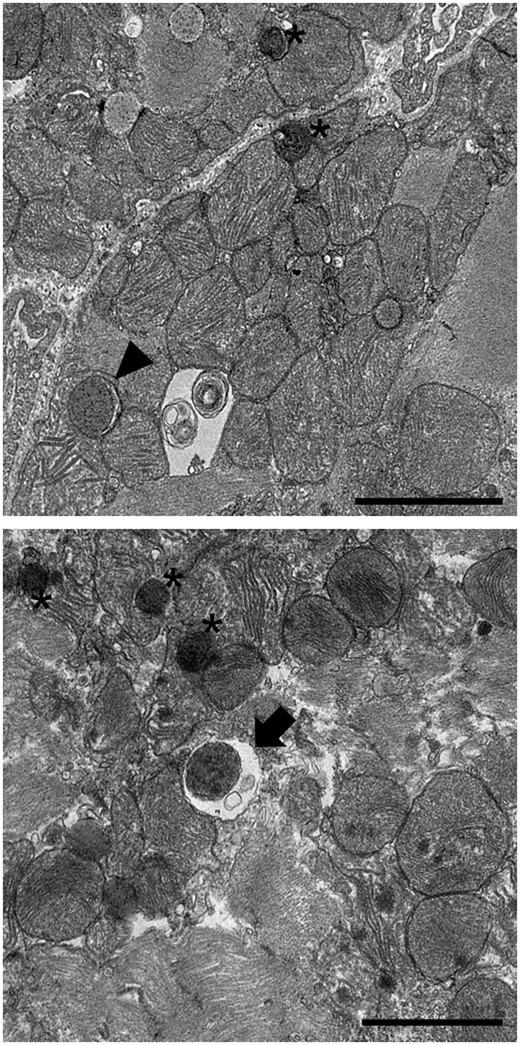 Electron microscopy analysis of autophagic structures. Three-month old male C57BL/6 mice were subjected to 30 min ischaemia and 2 h reperfusion, and hearts with infarction border area were analysed by electron microscopy. Representative images indicate an autophagosome (arrowhead), an autolysosome (arrow), and a lysosome (asterisk). Scale bar: 2 µm.