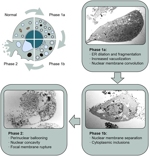Autosis. Schematic diagram and representative images of the different phases of autosis in HeLa cells, showing the most characteristic features of this type of cell death. Images from Liu and Levine licensed under a Creative Commons Attribution 3.0 Unported License (https://creativecommons.org/licenses/by/3.0/).