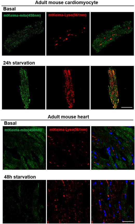 Mito-Keima as a mitophagy reporter to study cardiac mitophagy in mice. (Upper panel) Isolated adult mouse cardiomyocytes from 16-week-old male Mito-Keima mice with no treatment (basal) or 24 h starvation. (Lower panel) Mouse heart tissue from Mito-Keima mice with no treatment (basal) or after 48 h of starvation. Images were taken with a confocal microscope with sequential 458 nm and 561 nm excitations. Normal mitochondria are presented as green and mitophagy (mitochondria fused with lysosome) is presented as red. Scale bar: 25 µm.