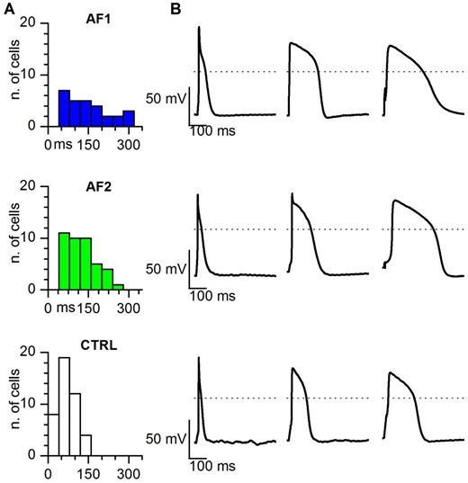 Action potential duration is longer in AF-CMs compared to CTRL-CMs. (A) Histograms of the distribution of the APD90 in AF1, AF2, and CTRL cells, as indicated. Bin size = 40 ms. (B) Representative action potentials with the shortest (left), average (centre), and longest (right) APD90 recorded at 1 Hz stimulation in AF1 (top), AF2 (middle), and CTRL (bottom) CMs. Dashed lines indicate the 0 mV level.