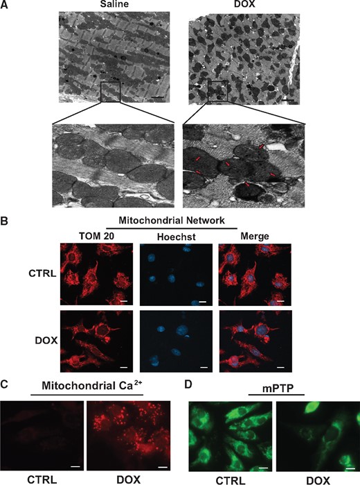 Dox provokes morphological and functional defects to mitochondria. Mitochondrial morphology in mice treated with saline (CTRL) or Dox. (A) Representative electron micrograph (5800× magnification) of heart muscle derived from saline (0.9%) and Dox (20 mg/kg) treated mice, with magnified insets below, scale bar 2 µm. (Left panel) Saline-treated mice exhibit normal mitochondrial morphology. (Right panel) Dox-treated mice displaying abnormal mitochondria with disrupted cristae and electron dense granules consistent with calcium deposits (red arrows). (B) Mitochondrial morphology assessed by epifluorescence microscopy using mitochondrial outer membrane protein Tom 20 (Red) and nuclear DNA (blue, Hoechst 33258), scale bar 10 µm. (C) Representative images of mitochondrial calcium uptake by Rhod-2AM (red fluorescence, see Section 2 for details), scale bar 10 µm. (D) Mitochondrial permeability transition pore (mPTP) opening assessed by using Calcein-AM in the presence of cobalt chloride, loss of green fluorescence indicates mPTP opening, scale bar 10 µm.