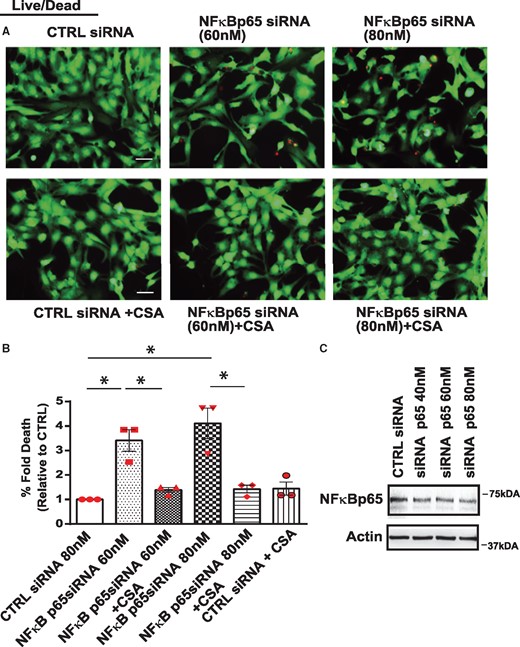Inhibition of cyclophilin D suppresses cell death in cardiac myocytes following NF-κB knock-down. Cardiomyocytes expressing scrambled siRNA or siRNA directed against NF-κB p65 (60 nM and 80 nM) assessed for cell viability assay in the absence and presence of CSA. (A) Representative images for cell viability, scale bar 40 µm. (B) Histogram shows quantitative data for A. Data are expressed as mean ± SEM derived from n = 3 independent experiments. Statistical significance between the groups marked in the histogram, analysed by one-way ANOVA and Bonferroni post hoc test, CTRL vs. NF-κB p65si 60 nM *P = 0.0015; CTRL vs. NF-κB p65si 80 nM *P = 0.0002; NF-κB p65si 60 nM vs. NF-κB p65si 60 nM+CSA *P = 0.006; NF-κB p65si 80 nM vs. NF-κB p65si 80 nM+CSA*P = 0.0006. (C) WB analysis of the cell lysate derived from cells expressing siRNA directed against NF-κB p65siRNA (40 nM, 60 nM, and 80 nM) or scrambled siRNA (80 nM). Actin served as a protein loading control.