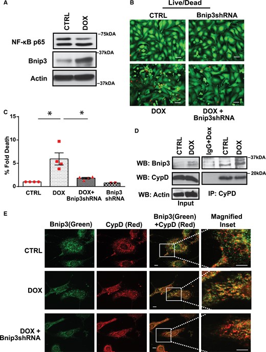 Bnip3 interacts with CypD and promotes cell death in cardiac myocytes deficient for NF-κB. (A) WB analysis of cardiac cell lysate derived from CTRL and Dox-treated cells to assess NF-κBp65 and Bnip3 protein expression. Actin served as a loading control. (B) Representative fluorescence images of cell viability for cardiac myocytes treated with vehicle or Dox in the absence and presence of Bnip3 short hairpin encoding (Bnip3shRNA) adenovirus, scale bar 40 µm. (C) Histogram represents quantitative data for B. Data are expressed as mean ± SEM derived from at least n = 3 independent cardiomyocyte isolations. Statistical significance between the groups marked in the histogram, analysed by one-way ANOVA and Bonferroni post hoc test, Dox vs. CTRL, *P = 0.002; Dox vs. Dox+Bnip3shRNA, *P = 0.0068. (D) IP assay was performed on CTRL and Dox treated ventricular myocytes, using Cyclophilin D antibody, the filter was blotted with Bnip3 antibody. (E) Immunofluorescence staining was performed for Bnip3 (green) and CypD (Red) on CTRL and Dox-treated ventricular myocytes in the absence and presence of Bnip3shRNA, scale bar 5µm.