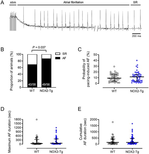 NOX2-Tg mice are more prone to pacing-induced AF. (A) Surface ECG recordings illustrate episodes of atrial tachyarrhythmias resembling AF, characterized by absent P-waves and increased R-R interval variance, with recovery of sinus rhythm (SR). (B) Percentages of NOX2-Tg and WT mice with inducible AF episodes lasting at least 2 s. Note higher incidence of pacing-induced AF (≥2 s) in NOX2-Tg mice (P = 0.037; n = 58 WT and n = 56 NOX2-Tg mice). (C) The probability of AF induction was not different between genotypes (P = 0.83; n = 40 WT and n = 49 NOX2-Tg mice). Maximum AF duration (D) and cumulative AF duration (E) tended to be longer in NOX2-Tg mice but was not statistically significant (P > 0.05; n = 40 WT and n = 49 NOX2-Tg mice). Categorical data are shown as percentages and P-values were calculated using the Fisher’s exact test. Continuous data are shown as individual data points with medians and IQRs and P-values were calculated using the Mann–Whitney U test.