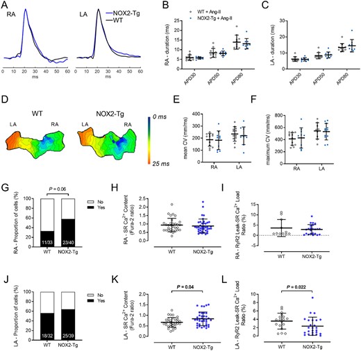 Atrial action potentials, conduction velocity, and diastolic Ca2+ leak in WT and NOX2-Tg atria following exposure to ANG-II. (A) Representative RA and LA optical action potentials recorded from WT or NOX2-Tg atria incubated with ANG-II. Summarized data for APD30, APD50, and APD80 in the RA (B) and LA (C) show no significant difference between WT and NOX2-Tg mice. Statistical significance between groups was determined for each APD using unpaired Student’s t-test. n = 11 and 9–10 for WT and NOX2-Tg atria, respectively. (D) Representative activation maps of a single spontaneous wave depolarization show a similar pattern of impulse conduction in WT and NOX2-Tg atria. Each isochrone line represents 1 ms. Summarized CV data show no significant difference in mean (E; n = 12 for WT and n = 10 for NOX2-Tg) or maximum (F; for RA, n = 12 for WT and n = 10 for NOX2-Tg; for LA, n = 9 for WT and n = 12 for NOX2-Tg) CV in the RA or LA between genotypes. Statistical significance between groups was determined for each parameter using unpaired Student’s t-test. (G) Diastolic Ca2+ leak was present in a greater proportion of NOX2-Tg RA myocytes (58%, 23/40 cells) compared with WT controls (33%, 11/33 cells) (P = 0.06, Fisher’s exact). The SR Ca2+ content (H) and the RyR2 leak—SR load ratio (I) was similar between NOX2-Tg (n = 23 cells from 9 mice) and WT RA myocytes (n = 11 cells from 9 mice). (J) The proportion of cells with diastolic Ca2+ leak was not different between NOX2-Tg and WT LA myocytes (P = 0.63, Fisher’s exact). (K) SR Ca2+ content was significantly greater in NOX2-Tg LA myocytes (n = 38 cells from 11 mice; 0.785, 25th–75th percentile: 0.56–1.02) compared with WT (n = 32 cells from 8 mice; 0.64, 25th–75th percentile: 0.52–0.81; P = 0.04), which meant that the RyR2 leak—SR load ratio (L) was reduced in NOX2-Tg LA myocytes (F365/380: 1.93, 25th–75th percentile: 0.64–3.78 for NOX2-Tg LA vs. 3.94, 25th–75th percentile: 2.3–4.7 for WT LA, P = 0.022, Mann–Whitney U test). Graphs show individual data points with means and SDs or medians and IQRs, as appropriate.