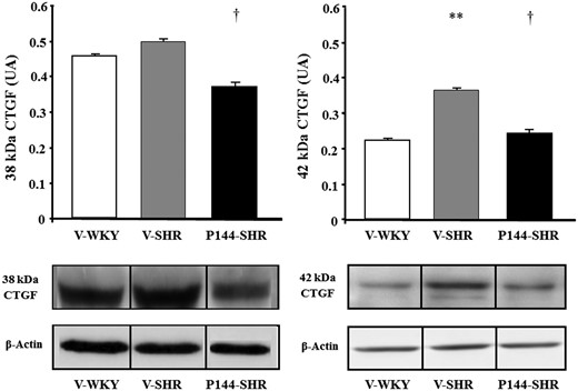 Expression of the 38 kDa and 42 kDa isoforms of connective tissue growth factor (CTGF) relative to ß–actin in the left ventricle of vehicle-treated Wistar-Kyoto rats (V-WKY), vehicle-treated spontaneously hypertensive rats (V-SHR), and P144-treated SHR (P144-SHR). Histograms represent mean ± SEM (n = 10) and AU means arbitrary units. ** P < 0.01 vs V-WKY; † P < 0.05 vs V-SHR. Representative Western blot of 38 kDa CTGF and 42 kDa CTGF and ß–actin in the 3 groups of rats are shown in the bottom part of the figures. Western blot autoradiogram bands have been spliced to be presented in the same order as conditions were displayed in the histogram.