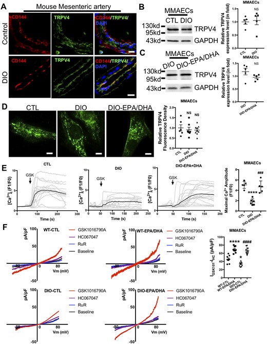 Omega-3 PUFAs enhance endothelial TRPV4 activity in diet-induced obese (DIO) mice. (A) Co-immunostaining of TRPV4 and CD144 in mouse mesenteric artery. Scale bar: 15 µm. (B and C) Western blots and analyses for anti-TRPV4 antibody in CTL, DIO (B), and DIO, EPA (30 µmol/L)/DHA (30 µmol/L)-treated DIO (C) mouse mesenteric artery endothelial cells (MMAECs). N = 5. (D) Representative images (left) and data summary (right) of TIRFM of TRPV4 in CTL (N = 6), DIO (N = 7), and EPA (30 µmol/L)/DHA (30 µmol/L)-treated DIO (N = 9) MMAECs. Scale bar: 10 µm. (E) Representative Ca2+ traces (left) and data summary (right) of CTL (N = 5), DIO (N = 6), and EPA (30 µmol/L)/DHA (30 µmol/L)-pretreated DIO (N = 5) MMAECs challenged with GSK1016790A (100 nmol/L). (F) Representative I-V curves from whole-cell patch-clamp recordings (left) and summary data (right) from WT and DIO mouse endothelial cells treated with or without EPA (30 µmol/L)/DHA (30 µmol/L) challenged with GSK1016790A (100 nmol/L), HC067047 (10 µmol/L) and ruthenium-red (5 µmol/L). WT-CTL, N = 8; WT-EPA/DHA, N = 9; DIO-CTL, N = 10; DIO-EPA/DHA, N = 11. (Mean ± SEM; B and C, NS, no significant difference vs. CTL, Student’s unpaired two-tailed t-test; D, NS, no significant difference vs. CTL, one-way analysis of variance test followed by Tukey's multiple comparisons test; E, ****P < 0.0001 vs. CTL, ###P = 0.0002 vs. DIO, one-way analysis of variance test followed by Tukey's multiple comparisons test; F, ****P < 0.0001 vs. WT-CTL, *P = 0.0127 vs. WT-CTL, ####P < 0.0001 vs. DIO-CTL, one-way analysis of variance test followed by Tukey's multiple comparisons test).