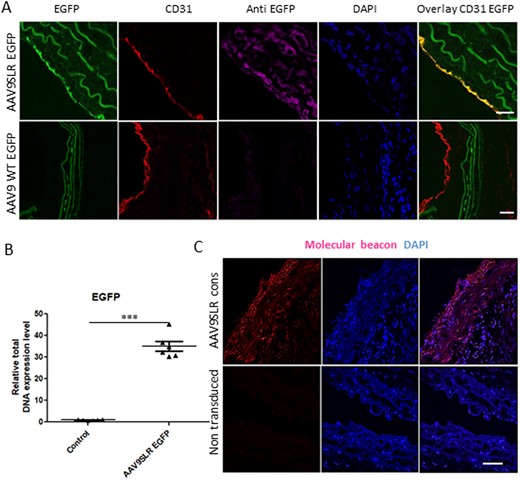 AAV9SLR-mediated AP-1 hp dONs generation in aortic grafts of mgR/mgR mice following transduction. (A) EGFP immunohistochemistry (magenta) was performed on aortic cryosections from mgR/mgR mice 30 days after ex vivo transduction with AAV9SLR. Positive staining was obtained in CD31 positive endothelial cells (red), as well as in the medial SMCs. (B) Quantification of EGFP vector genome copies among total DNA, confirming successful transduction of aortic grafts (n = 6, ***P < 0.001). (C) Illustrative images showing the formation of RNA AP-1 hp dONs 4 weeks post-transduction of aortic grafts with AAV9SLR, documented by RNA F.I.S.H. Red fluorescence indicates specific hybridization of the molecular beacon to the hairpin RNA target. Nuclei were stained with DAPI (blue). Scale bar represents 25 µm. Data were analysed using Mann–Whitney U-test.