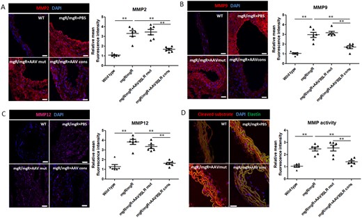AAV9SLR-mediated AP-1 cons hp dONs delivery significantly down-regulates the expression and activity of MMPs in ex vivo treated aortic grafts of mgR/mgR mice. Immunofluorescent analysis (red) of MMP2 (A), MMP9 (B), and MMP12 (C) protein abundance in aortic cryosections of the different treatment groups. (D) Representative images of in situ zymography using a broad-spectrum FRET MMP substrate. Red fluorescence represents the cleaved compound and was quantified as the level of MMP activity. Elastin autofluorescence was recorded in the green channel and DAPI (blue) was used to counterstain nuclei. The graphs represent the statistical quantification of red fluorescence in confocal microscopy images. The values of wild type mice served as controls and were set to 1. Scale bar represents 25 μm (n = 6, **P < 0.01). Data were analysed using one-way analysis of variance (ANOVA), followed by a post hoc Tukey multiple comparison test.