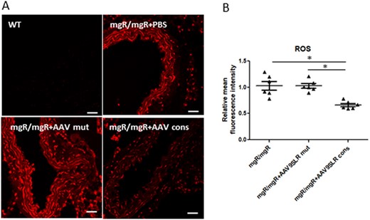 AAV9SLR-mediated AP-1 cons hp dONs expression significantly decrease the amount of superoxide in ex vivo transduced aortic grafts from mgR/mgR mice. (A) ROS production in transduced aortic cryosections was assessed using DHE staining (red). Scale bar represents 25 μm. (B) Analysis of DHE-derived mean fluorescence intensity with the aortic frozen sections from non-treated mgR/mgR mice set to 1 (n = 6, 20 images analysed/group, *P < 0.05). The complete data set of the original images is presented in the Supplementary material online, SupplMat_Figure6.pdf.