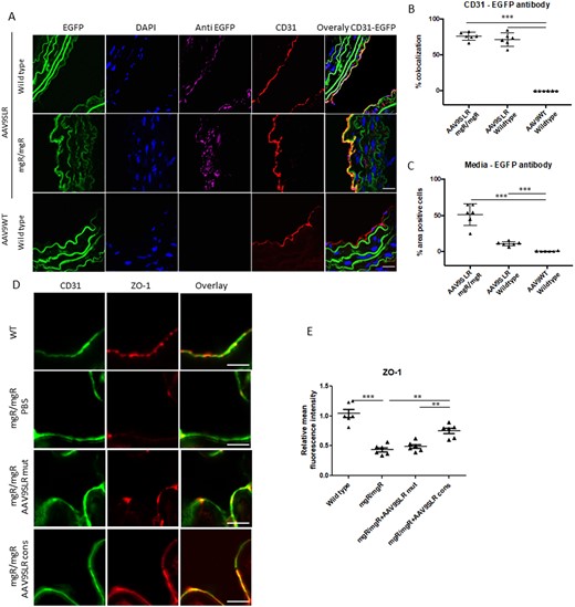 AAV9SLR-mediated AP-1 cons hp dONs generation significantly increases the expression of tight junction protein ZO-1 in ex vivo transduced aortic grafts from mgR/mgR mice. (A) Representative images showing AAV9SLR-EGFP transduction efficiency in aortic grafts from mgR/mgR and wild type mice. CD31 (red) staining was used to mark endothelial cells, and EGFP immunohistochemistry (magenta) was employed to determine EGFP positive cells. Elastin fibre autofluorescence (green) and DAPI nuclear staining (blue) are also shown. The scale bar represents 25 μm (n = 3, exemplary images). (B) Statistical quantification of percentage colocalization of CD31 and EGFP signal, as a marker of endothelial cell transduction. (C) Evaluation of EGFP positive cells in the media of transduced aortic tissue from mgR/mgR and wild-type mice, quantified as percentage area. (D) Representative confocal images of aortic cryosections from mgR/mgR mice stained with antibodies recognizing CD31 (green) and ZO-1 (red) as well as statistical quantification of ZO-1 protein abundance (E). The scale bar represents 75 μm (n = 6 for WT mice, n = 6 for mgR/mgR mice, 20 images were analysed/group, **P < 0.01, ***P < 0.001).