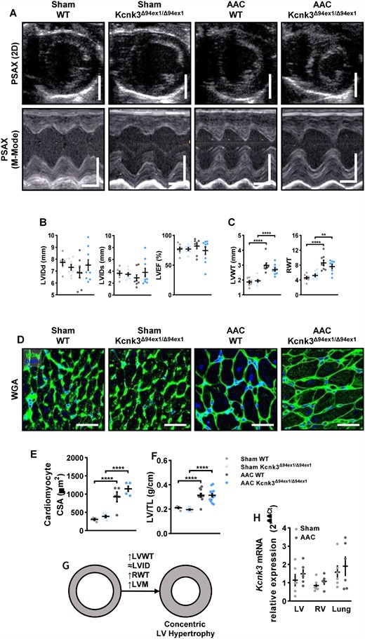 AAC-induced LV pressure overload leads to concentric hypertrophy. (A) Parasternal short axis (PSAX) projection with M-mode was used to quantify left ventricle structure and function. Scale bars, 5 mm (upper panels), horizontal bars represent 100 ms. (B) LViDd, LVIDs, LVEF in LV from Sham-WT (n = 7), Sham-Kcnk3Δ94Ex1/Δ94Ex1 (n = 7–8), AAC-WT (n = 8), and AAC-Kcnk3Δ94Ex1/Δ94Ex1 rats (n = 9). (C) LVWT, RWT in LV from Sham-WT (n = 7), Sham-Kcnk3Δ94Ex1/Δ94Ex1 (n = 8), AAC-WT (n = 8), and AAC-Kcnk3Δ94Ex1/Δ94Ex1 rats (n = 9). (D) Immunofluorescence images of LV sections stained with FITC-conjugated wheat germ agglutinin (WGA, 50 μg/mL, green) and 4′,6-diamidino-2-phenylindole (DAPI, blue). Scale bar, 50 μm. (E) Quantification of cardiomyocytes cross section area (CSA, five different rats for each group). (F) LV/TL in Sham-WT (n = 5), Sham-Kcnk3Δ94Ex1/Δ94Ex1 (n = 10), AAC-WT (n = 11), and AAC-Kcnk3Δ94Ex1/Δ94Ex1 rats (n = 15). (G) Schematic representation of concentric LV hypertrophy. (H) Relative mRNA expression (2−ΔΔCt) of kcnk3 in LV, RV, lung from Sham-WT (n = 5–6), and AAC-WT rats (n = 5–6). Experiments were normalized to 18S mRNA and statistical analysis performed using ΔCt values. Data are represented as scatter dot plots, with mean ± SEM. Experiments presented in panels A–D and F–H were analysed using two-way ANOVA followed by Sidak’s post hoc test, and experiments presented in panel E were analysed using one-way ANOVA followed by Dunn’s post hoc test after Kruskal–Wallis test, **P < 0.01, ****P < 0.0001. LVEF, LVWT, cardiomyocyte CSA, and LV/TL were not normally distributed and were log-transformed prior to statistical analysis.