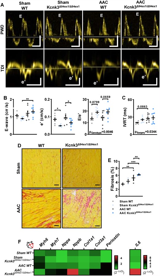 Kcnk3-LOF mutation leads to LV diastolic dysfunction. (A) Mitral inflow and mitral annulus velocity analysis, using pulse wave Doppler (PWD) and tissue-Doppler imaging (TDI). Vertical bars, 50 (upper) and 5 (lower panel) cm/s, horizontal bars represent 100 ms. (B) Left panel: E-wave, middle panel: e′, right panel: E/e′ from Sham-WT (n = 6–7), Sham-Kcnk3Δ94Ex1/Δ94Ex1 (n = 7–8), AAC-WT (n = 7–8), and AAC-Kcnk3Δ94Ex1/Δ94Ex1 rats (n = 8–9). (C) IVRT from Sham-WT (n = 5), Sham-Kcnk3Δ94Ex1/Δ94Ex1 (n = 8), AAC-WT (n = 8), and AAC-Kcnk3Δ94Ex1/Δ94Ex1 rats (n = 9). (D) Representative images of interstitial collagen deposition in LV tissue sections stained with sirius red from WT and Kcnk3-mutated sham or AAC rats. Scale bar, 100 µm. (E) Analysis of the percentage of LV interstitial collagen staining in Sham-WT (n = 3), Sham-Kcnk3Δ94Ex1/Δ94Ex1 (n = 3), AAC-WT (n = 4), and AAC-Kcnk3Δ94Ex1/Δ94Ex1 rats (n = 3). (F) Relative mRNA expression (2−ΔΔCt) of Myh6, Myh7, Nppa, Nppb Col1a1, Col3a1, Periostin, and IL-6 (heatmap representation of the mean) in LV from Sham-WT (n = 6), Sham-Kcnk3Δ94Ex1/Δ94Ex1 (n = 5), AAC-WT (n = 6), and AAC-Kcnk3Δ94Ex1/Δ94Ex1 rats (n = 6). Experiments were normalized by 18S mRNA and analysed using ΔCt values (for a full statistical analysis refer to the Supplementary material online). Data are represented as scatter dot plots, with mean ± SEM. Experiments presented in panels A–D and F were analysed using two-way ANOVA followed by Sidak’s post hoc test, and experiments presented in panel E were analysed using one-way ANOVA followed by Dunn’s post hoc test after Kruskal–Wallis test. *P < 0.05, **P < 0.01, and ***P < 0.001. Fibrosis was not normally distributed and was log-transformed prior to statistical analysis.