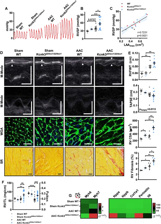 Pulmonary hypertension is exaggerated in Kcnk3-mutated rats with AAC. (A) Representation of the record of right ventricular pressure (RVP in mmHg) using right heart catheterization. (B) Quantification of RVSP (in mmHg) (SHAM; WT = 5, Kcnk3Δ94Ex1/Δ94Ex1 = 8, AAC; WT = 13, Kcnk3Δ94Ex1/Δ94Ex1 =19 rats). (C) Correlation (Spearman) between RVSP and LAAmax in AAC-WT (n = 3), AAC-Kcnk3Δ94Ex1/+ (n = 6), and AAC-Kcnk3Δ94Ex1/Δ94Ex1 (n = 5) rats. (D) M-mode echocardiographic determination of RV free wall thickness (RVFW) and tricuspid annular plane systolic excursion (TAPSE, upper panels). Representative images of RV cardiomyocytes size (WGA staining) and RV interstitial collagen deposition (Sirius red staining, lower panels). Vertical bars, 0.5 cm (M-Mode) and horizontal bars represent 100 ms, 50 μm (WGA staining), and 100 μm (Sirius red). (E) First panel: RVFWT; and second panel: TAPSE from Sham-WT (n = 7), Sham-Kcnk3Δ94Ex1/Δ94Ex1 (n = 7–8), AAC-WT (n = 8), and AAC-Kcnk3Δ94Ex1/Δ94Ex1 rats (n = 9). Third panel: RV cross-section area; and fourth panel: analysis of the percentage of RV interstitial collagen staining from Sham-WT (n = 5), Sham-Kcnk3Δ94Ex1/Δ94Ex1 (n = 5), AAC-WT (n = 5), and AAC-Kcnk3Δ94Ex1/Δ94Ex1 rats (n = 5). (F) RV/tibia length ratio and Fulton index from Sham-WT (n = 5–8), Sham-Kcnk3Δ94Ex1/Δ94Ex1 (n = 9–11), AAC-WT (n = 9–14), and AAC-Kcnk3Δ94Ex1/Δ94Ex1 rats (n = 14–17). (G) Relative mRNA expression (2−ΔΔCt) of Myh6, Myh7, Nppa, Nppb, Col1a1, Periostin, and IL-6 (heatmap representation of the mean) in RV from Sham-WT (n = 6), Sham-Kcnk3Δ94Ex1/Δ94Ex1 (n = 5), AAC-WT (n = 6), and AAC-Kcnk3Δ94Ex1/Δ94Ex1 rats (n = 7). Experiments were normalized by 18S mRNA and analysed using ΔCt values (for a full statistical analysis refer to the supplemental material). Data are represented as scatter dot plots, with mean ± SEM. Experiments were analysed using two-way ANOVA followed by Sidak’s post hoc test after Kruskal–Wallis test. *P < 0.05, **P < 0.01, ***P < 0.001, and ****P < 0.0001. RVSP, RV CSA, RV Fibrosis, RV/TL, and Fulton were not normally distributed and were log-transformed prior to statistical analysis.