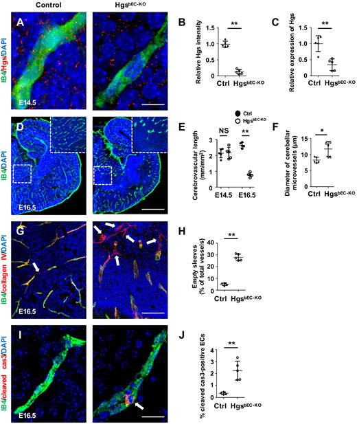 Deletion of Hgs in brain ECs disrupts cerebrovascular stability. (A) Hgs and IB4 immunostaining on brain sections of E14.5 control and HgsbEC-KOembryos showing the absence of Hgs in HgsbEC-KO mutant brain ECs. Scale bar: 15 µm. (B) Quantification showing a significant decrease of relative Hgs intensity in IB4-positive vessels vs. Hgs intensity outside IB4-positive vessels in HgsbEC-KO mice (n = 5). (C) Real-time PCR analyses of Hgs expression in primary isolated brain ECs derived from E14.5 control and HgsbEC-KO embryos (n = 5). (D) IB4 immunostaining of brain vasculature showing abnormal capillary morphology in HgsbEC-KO embryos at E16.5. Scale bar: 800 µm. (E) Quantification of brain vasculature density in control and HgsbEC-KO embryos at E14.5 and E16.5 (n = 5). (F) Quantification of the brain microvascular diameters in control and HgsbEC-KO embryos at E16.5. (G) IB4 and collagen IV immunostaining showing increased brain vascular regression in E16.5 HgsbEC-KO embryos. Arrows indicate collagen IV-positive, IB4-negative empty endothelial sleeves. Scale bar: 100 µm. (H) Quantification of empty endothelial sleeves in brains of E16.5 control and HgsbEC-KO embryos (n = 5). (I) Cleaved-caspase 3 (cleaved cas3) immunostaining showing an apoptotic brain EC (arrow) in an E16.5 HgsbEC-KO embryo. Scale bar: 25 µm. (J) Quantification indicating increased apoptotic ECs in brains of E16.5 HgsbEC-KO mutants (n = 5). Values are presented as means ± standard deviation. *P < 0.05; **P < 0.01 and NS, not significant (P ≥ 0.05) by Mann–Whitney test.