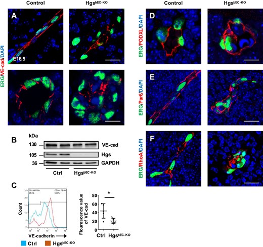 Loss of brain endothelial Hgs impairs EC polarity. (A) Confocal images of ERG and VE-cadherin double immunostaining on transverse sections (upper panel) and coronal sections (lower panel) showing the loss of lateral distribution of VE-cadherin in E16.5 HgsbEC-KO brain ECs. Scale bar: 20 µm (upper panel) and 10 μm (lower panel). (B) Western blot analyses of Hgs and VE-cadherin expression in isolated brain ECs of E16.5 control and HgsbEC-KO embryos. (C) Flow cytometry analyses of membranous VE-cadherin and the quantification showing a decreased fluorescence intensity in brain ECs of HgsbEC-KO embryos compared with controls at E16.5 (n = 5). (D) Confocal images of PODXL immunostaining showing the disordered apical surface in the clustered brain ECs of E16.5 HgsbEC-KO embryos. Scale bar: 10 µm. (E and F) Confocal images of mislocalized Par6 (E) and RhoA (F) in brain ECs of HgsbEC-KO mice at E16.5. Scale bar: 20 µm. Values are presented as means ± standard deviation. *P < 0.05 by Mann–Whitney test.