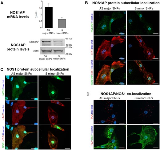 NOS1AP and NOS1 expression and localization in S vs. AS hiPSC-CMs. (A) comparison of NOS1AP transcript (top) and protein levels (bottom) between AS and S hiPSC-CMs (actin as loading control). (B) Immunostaining for NOS1AP protein (green) in AS and S hiPSC-CMs. (C) Immunostaining for NOS1 protein (green) in AS and S hiPSC-CMs. (D) NOS1AP/NOS interaction evaluated by the PLA, in AS and S hiPSC-CMs; interaction is revealed by bright red cytosolic dots. In B and C, the lower panels show the same field stained for the cardiac sarcomeric protein troponin T (cTnT, red) alone (middle) and in overlap (bottom); in D, PLA signals are overlapped with cTnT (bottom panel); nuclei in blue (Hoechst 33258). Scale bars = 20 µm. Sample size: AS n = 6/3 and S n = 6/3 for A. *P < 0.01 vs. AS from the unpaired Student’s t-test.