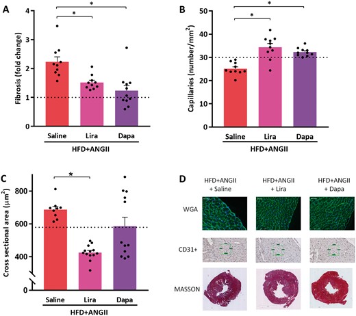 Treatment effects of Lira or Dapa on cardiac fibrosis and cardiac hypertrophy. (A) Histological analysis of fibrosis, expressed in fold-change compared to reference control values (n = 10–11 mice per group). (B) Capillary density determined by number of capillaries per mm2 positive stained by CD31+ (n = 10 mice per group). (C) Cross-sectional area of cardiomyocytes quantified by WGA-FITC staining (30–50 cells per animal, n = 9–13 mice per group. (D) Representative images of histological staining depicting the cardiomyocyte size (WGA), capillary density (CD31+), and fibrosis (Masson). Dotted lines represents control reference values; HFD + ANGII + Dapa, high-fat diet + angiotensin II with dapagliflozin treatment; HFD + ANGII + Lira, high-fat diet + angiotensin II with daily liraglutide injection; HFD + ANGII + Saline, high-fat diet + angiotensin II with saline injections. Data are presented as mean + standard errors of the mean. *Kruskal–Wallis test followed by Mann–Whitney U test P <0.05 is considered significant.
