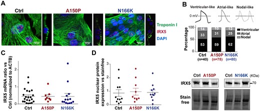 Characterization of IRX5-mutated hiPS-cardiomyocytes. (A) Illustrative immunostainings of IRX5 (red) and Troponin I (green) in hiPS-CMs, merged with a nuclear staining using DAPI (blue). To confirm nuclear localization of IRX5, XZ orthogonal planes are illustrated next to each picture. (B) Representative traces and distribution (as percentage) of nodal-like, atrial-like, and ventricular-like cells, based on the analysis of AP parameters in spontaneously beating hiPS-CMs (Ctrl: n = 40; A150: n = 78; N166K: n = 80). (C) IRX5 mRNA expression level in control and mutated hiPS-CMs at Day 28 of cardiac differentiation using TaqMan® technique (Ctrl: n = 22; A150P: n = 8; N166K: n = 14). (D) Nuclear expression level of IRX5 protein in control and mutated hiPS-CMs, normalized to Stain free. Representative immunoblot showing IRX5 expression in the nuclear protein fraction (Ctrl: n = 11; A150P: n = 10; N166K: n = 11).