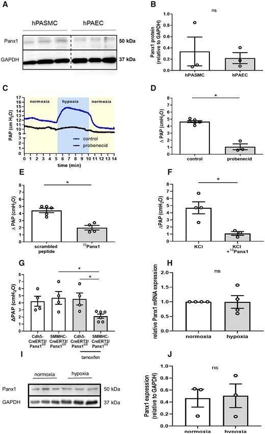 Smooth muscle Panx1 is required for the intact HPV response. Representative western blot (A) and quantitative densitometric analysis (B) show expression of Panx1 in human pulmonary artery smooth muscle cells (hPASMCs) and human pulmonary artery endothelial cells (hPAECs). GAPDH served as loading control (n = 3 per group). Panx1 expression on hPASMC and hPAEC were assessed on the same gel. Interspersed non-relevant lanes were removed and relevant sections were re-composed at the dotted line. Representative tracing (C) of pulmonary artery pressure (PAP) in isolated perfused mouse lungs and quantitative group data analysis (D) show attenuation of the vasoconstrictive response to hypoxia (1% O2)—measured as increase in PAP (ΔPAP)—by probenecid (50 mg/kg bw) (control n = 6, probenecid n = 3). (E) The pannexin 1 (Panx1) specific inhibitory peptide (10Panx1; 800 µMol/L) reduces the ΔPAP response to hypoxia by more than 50% as compared to scrambled peptide control (scrambled peptide n = 5, 10Panx1 n = 4). (F) Pulmonary vasoconstriction in response to KCl was attenuated by 10Panx1 (800 µMol/L) (KCl n = 4, KCl+10Panx1 n = 3). (G) Tamoxifen induced deletion of Panx1 in smooth muscle cells (SMMHC-CreERT2/Panx1fl/fl), yet not Panx1 deletion in endothelial cells (Cdh5-CreERT2/Panx1fl/fl) attenuates ΔPAP response to hypoxia in isolated perfused murine lungs (n = 4–5 per group). (I and J) Hypoxia did neither change Panx1 RNA levels (n = 4 per group) nor Panx1 protein expression (n = 3 per group). Data are mean ± SEM; Data were analysed using Mann–Whitney U-test (A–F, H–J) or Kruskal–Wallis test (Figure test); *P < 0.05; ns, not significant.