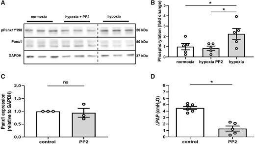 Hypoxia induces Panx1 phosphorylation at Tyr198. Representative western blot (A) and quantitative densitometric analysis (B) show increased phosphorylation of Panx1 at residue Tyr198 (pPanx1Y198) in hypoxic as compared to normoxic hPASMC that is blocked by PP2 (10 µMol/L) (n = 5 per group). Panx1 phosphorylation on hPASMC and hPAEC were assessed on the same gel. Interspersed non-relevant lanes were removed and relevant sections were re-composed at the dotted line. (C) PP2 did not alter Panx1 expression. (D) In isolated perfused mouse lungs, PP2 (20 µMol/L) attenuated the vasoconstrictive response to hypoxia (1% O2), measured as increase in pulmonary artery pressure (ΔPAP) (control n = 6, PP2 n = 5). Data are mean ± SEM; data were analysed using Kruskal–Wallis test (B) or Mann–Whitney U-test (C and D); *P < 0.05.