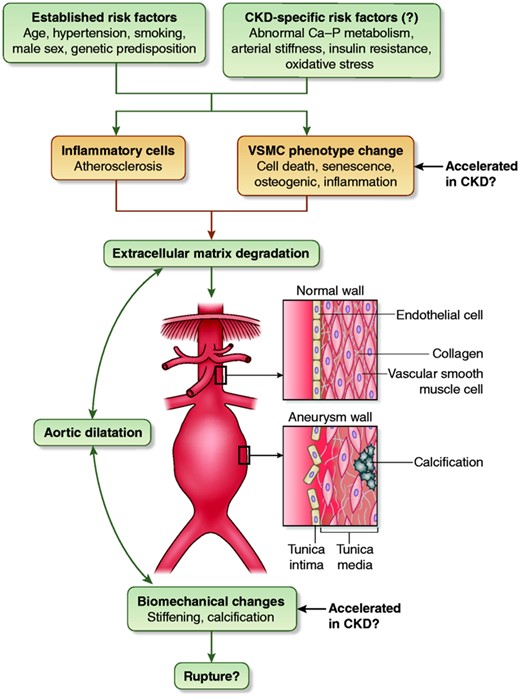 Established and potential CKD-specific risk factors and pathophysiologic mechanisms for AAA development.