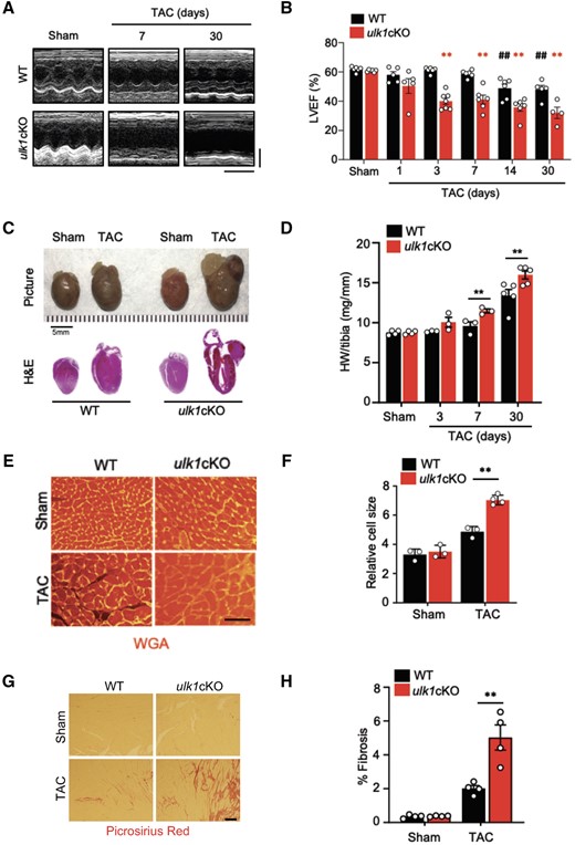 Down-regulation of Ulk1 exacerbates cardiac dysfunction after TAC. Three- to 4-month-old WT and ulk1cKO mice were subjected to either sham operation or TAC for 1, 3, 7, 14, and 30 days. (A) Representative echocardiographs. Scale bars, vertical 2.5 mm and horizontal 250 ms. (B) % of LVEF was evaluated by echocardiography. **P < 0.01 vs. ulk1cKO sham; ##P < 0.01 vs. WT sham. Statistical analyses were conducted with two-way ANOVA followed by Šídák’s multiple comparisons test. (C) Gross morphology and heart sections of WT and ulk1cKO mice stained with haematoxylin and eosin (H&E) staining. Scale bars, 5.0 mm. (D) Heart weight to tibia length (HW/tibia) ratio. *P < 0.05 vs. WT at each time point. Mean values ± S.E. are shown. Statistical analyses were conducted with two-way ANOVA followed by Šídák’s multiple comparisons test. (E and F) Left ventricles were fixed, sectioned, and stained with Wheat Germ Agglutinin (WGA). Scale bars, 500 µm (E). Relative cell size was measured (F). Mean values ± S.E., **P < 0.01. Statistical analyses were conducted with two-way ANOVA followed by Tukey’s post hoc test. (G and H) Left ventricles were fixed, sectioned, and stained with Picrosirius red. Scale bars, 200 µm (G). Picrosirius red positive areas were measured (H). Mean values ± S.E., n = 4 each; **P < 0.01. Statistical analyses were conducted with two-way ANOVA followed by Šídák’s multiple comparisons test.