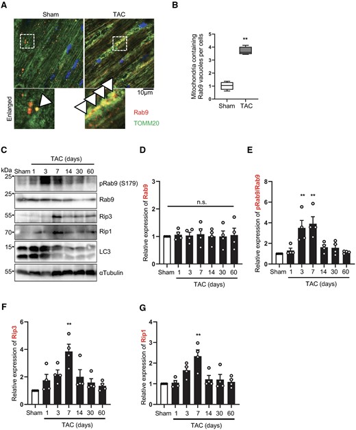 Alternative autophagy is induced during pressure overload in the heart. Three-month-old WT mice were subjected to either sham operation or TAC for 1, 3, 7, 14, 30, and 60 days. Hearts were analysed by confocal microscopy (A and B) or Western blotting (C–G) to assess alternative mitophagy. Representative fluorescence images of sham and 3-day TAC heart sections stained with anti-Rab9 antibody (red), anti-TOMM20 antibody (green), and DAPI (blue) (A). Arrowhead indicates co-localization of Rab9 and mitochondria. The graph shows quantification of double positive Rab9 and mitochondria dots (B). Mean values ± min to max., n = 4. Values were measured from four different slides per sample. **P < 0.01. Statistical analyses were conducted with unpaired Student’s t-test. Heart lysates were analysed by Western blotting using anti-Rip1, anti-Rip3, anti-phospho-Rab9 (S179), anti-Rab9, anti-LC3, and anti-αTubulin antibodies (C). The relative ratios of Rab9 to αTubulin (D), phospho-Rab9 to Rab9 (E), Rip1 to αTubulin (F), and Rip3 to αTubulin (G) were quantified. Mean values ± S.E. n = 4; **P < 0.01 vs. sham. Statistical analyses were conducted with one-way ANOVA followed by Dunnett’s multiple comparisons test.