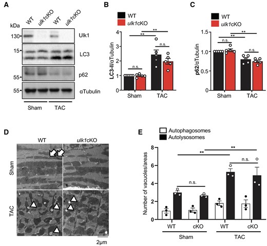 Conventional autophagy is preserved in ulk1cKO during the early stage of TAC. (A–E) 3–4-month-old WT and ulk1cKO mice were subjected to either sham operation or TAC for 12 h. Heart lysates were analysed by Western blotting using anti-Ulk1, anti-LC3, anti-p62, and anti-αTubulin antibodies (A). The relative ratios of LC3-II to αTubulin (B) and p62 to αTubulin (C) were quantified. Mean values ± S.E., n = 5; **P < 0.05. Statistical analyses were conducted with two-way ANOVA followed by Šídák’s multiple comparisons test. (D and E) Samples from hearts of mice subjected to TAC for 12 h were subjected to electron microscopic analysis. Autophagosomes (APs, arrows) and autolysosomes (ALs, arrowheads) are indicated (D). The number of cytoplasmic APs and ALs was counted. Mean values ±S.E., n = 3; each value was obtained from 10 different pictures. *P < 0.05. Statistical analyses were conducted with two-way ANOVA followed by Tukey’s post hoc test (E).