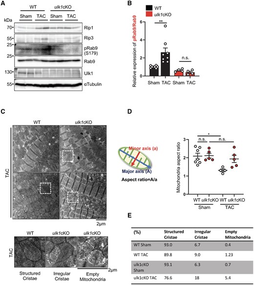 Alternative mitophagy is defective in ulk1cKO mice during TAC. (A–E) 3–4-month-old WT and ulk1cKO mice were subjected to either sham operation or TAC for 3 days. Heart lysates were analysed by Western blotting using anti-Rip1, anti-Rip3, anti-phospho-Rab9 (S179), anti-Rab9, anti-Ulk1, and anti-αTubulin antibodies (A). The relative ratios of phospho-Rab9 to Rab9 (B) were quantified. Mean values ± S.E., **P < 0.01. Statistical analyses were conducted with two-way ANOVA followed by Tukey’s post hoc test. (C–E) Samples from hearts of mice subjected to 3-day TAC were subjected to electron microscopic analyses. Representative EM images are shown in upper panel of (C). Enlarged mitochondria are shown in lower panel of (C). Mitochondria aspect ratio was quantified. Mean values ±S.E., *P < 0.05. Statistical analyses were conducted with two-way ANOVA followed by Šídák’s multiple comparisons test (D). Mitochondria were categorized by the morphology of cristae and quantified. The percentage of structured or irregular cristae and empty mitochondria was quantified (n = 5 each group) (E).