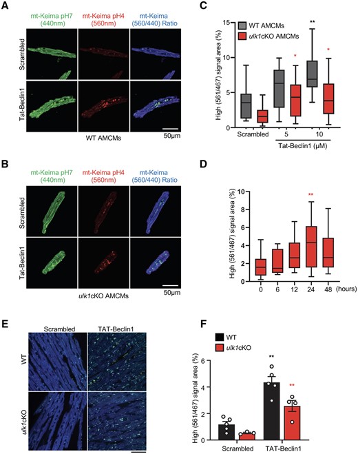 TAT-Beclin 1 peptide activates mitophagy in CMs and mouse heart. (A–D) Adult cardiomyocytes (CMs) were isolated from WT/Mito-Keima or ulk1cKO/Mito-Keima mice as described in Methods. Representative fluorescence images of adult CMs from WT/Mito-Keima (A) or ulk1cKO/Mito-Keima mice (B) (scale bar, 50 μm). The graph shows quantification of high (561 nm/467 nm) Keima signal area after TAT-Beclin 1 treatment (C and D). Mean values ± S.D., n = more than 10 cells per group; *P < 0.05, **P < 0.01 vs. scrambled of each group. Statistical analyses were conducted with two-way ANOVA followed by Tukey’s post hoc test (C) or one-way ANOVA followed by Dunnett’s multiple comparisons test (D). (E and F) 3-month old WT/Mito-Keima and ulk1cKO/Mito-Keima mice were injected with TAT-Beclin 1 for 24 h. Representative images are shown in (E) (scale bar, 100 μm). High (561 nm/467 nm) signal areas of Mito-Keima dots/total microscopic areas are shown in (D) and (F). Mean values ± S.E., n = 3–5 each group; *P < 0.05, **P < 0.01 vs. scrambled of each group. Statistical analyses were conducted with two-way ANOVA followed by Šídák’s multiple comparisons test.