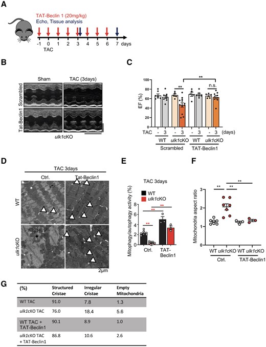 TAT-Beclin 1-induced mitophagy alleviates cardiac dysfunction in response to TAC in ulk1cKO. (A–G) 3- to 4-month-old WT and ulk1cKO mice were subjected to either sham operation or TAC for 7 days. TAT-Beclin 1 peptide was injected on a daily basis from 1 day before TAC surgery until 7 days after TAC, as described in (A). Representative echocardiographs. Scale bars, vertical 2.5 mm and horizontal 250 ms (B). % of LVEF was evaluated by echocardiography. Mean values ± S.E., *P < 0.05. Statistical analyses were conducted with two-way ANOVA followed by Tukey’s post hoc test (C). (D–G) Heart samples from mice subjected to TAC for 3 days were subjected to electron microscopic analyses. Representative EM images are shown. Arrowheads indicate autolysosomes (D) (Scale bar, 2 μm). Mitophagy/autophagy activity was quantified. Mean values ± S.E., **P < 0.01. Statistical analyses were conducted with two-way ANOVA followed by Tukey’s post hoc test (E). Mitochondria aspect ratios were quantified. Mean values ± S.E.; **P < 0.01. Statistical analyses were conducted with two-way ANOVA followed by Tukey’s post hoc test (F). Mitochondria were categorized by the morphology of cristae and quantified. The percentage of structured or irregular cristae and empty mitochondria were quantified (n = 3–6 each group) (E).