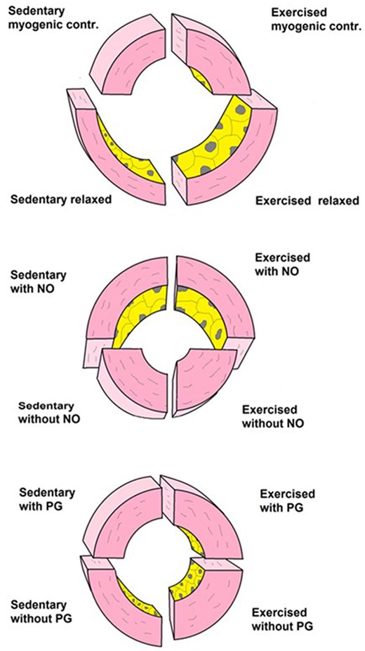 Illustration of morphological adaptations of small coronary arteries of rats to RAEX. Top panel: sedentary and exercised vessel in control condition at two intraluminal pressure values: upper half at 30 mmHg and lower half at 120 mmHg. RAEX elicits growth of vessels and thickening of vascular wall, resulting in reduced wall stress and increased elasticity of vessels. Middle panel illustrates the effect of NO, whereas the lower panel illustrates the effect of PG27 (with permission of Karger). NO, nitric oxide; PG, prostaglandin.