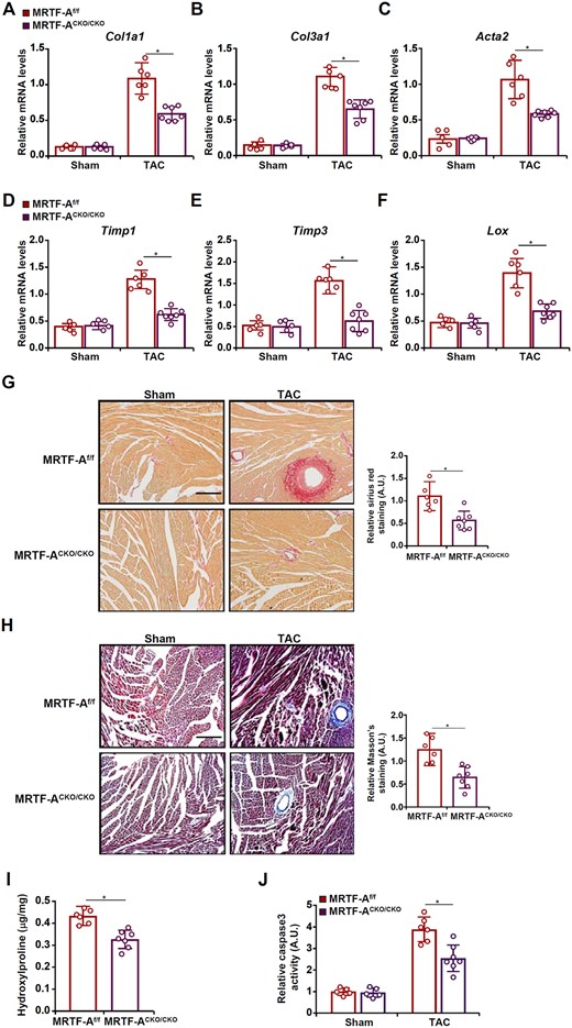 MRTF-A deletion in macrophages attenuates pressure overload-induced cardiac fibrosis in mice. Macrophage MRTF-A conditional knockout (MRTF-ACKO/CKO) mice and wild-type (MRTF-Af/f) littermates were subjected to the TAC procedure. (A–F) Fibrogenic genes were measured by qPCR. (G) Picrosirius red staining. (H) Masson’s trichrome staining. Scale bar, 50 µm. (I) Hydroxyproline levels. (J) Cell death was assessed with a colorimetric caspase 3 assay kit. N = 5 mice for the sham groups and N = 6–7 mice for the TAC groups. Data represent mean ± SD. *P < 0.05, two-tailed t-test.