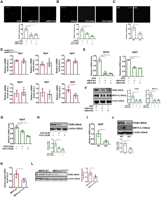 MRTF-A regulates adhesion of macrophages to endothelial cells by activating integrin β2 expression. (A) RAW cells were transfected with siRNA targeting MRTF-A or scrambled siRNA (SCR). Leucocyte adhesion assay was performed and quantified as described in Methods. Scale bar, 50 µm. N = 3. (B) Primary peritoneal macrophages were isolated from MFCKO mice and WT mice. Leucocyte adhesion assay was performed and quantified as described in Methods. Scale bar, 50 µm. N = 3. (C) RAW cells were treated with or without CCG-1423 (10 µM) for 24 h. Leucocyte adhesion assay was performed and quantified as described in Methods. Scale bar, 50 µm. N = 3. (D) Macrophage MRTF-A conditional knockout (MRTF-ACKO/CKO) mice and wild type (MRTF-Af/f) littermates were subjected to the TAC procedure. Expression levels of integrins were examined by qPCR. N = 4 mice for the MRTF-Af/f group and N = 6 mice for the MRTF-ACKO/CKO group. (E, F) RAW cells were transfected with siRNA targeting MRTF-A or scrambled siRNA (SCR). ITGB2 expression was examined by qPCR and Western. N = 3. (G, H) RAW cells were treated with or without CCG-1423 (10 µM) for 24 h. ITGB2 expression was examined by qPCR and Western. N = 3. (I, J) Primary peritoneal macrophages were isolated from MRTF-ACKO/CKO mice and WT mice. ITGB2 expression was examined by qPCR and Western. N = 3. (K, L) Primary cardiac macrophages were isolated from MRTF-ACKO/CKO mice and WT mice subjected to the TAC procedure. ITGB2 expression was examined by qPCR and Western. N = 5 mice for each group. Data represent mean ± SD. *P < 0.05, two-tailed t-test.