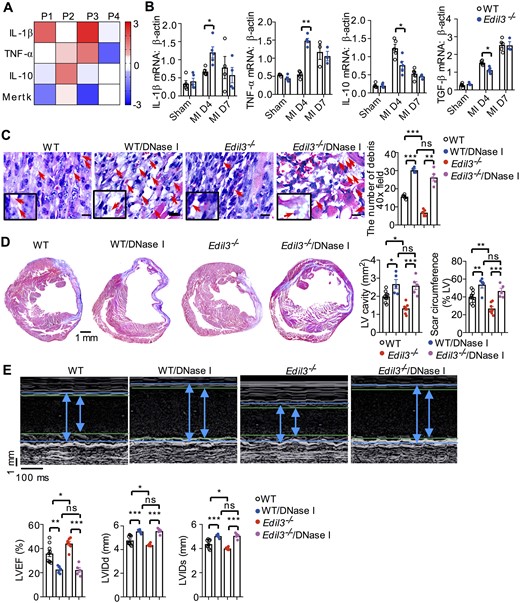 NET-mediated pro-inflammatory Mertk−MHC-IIlo-int macrophage polarization improved cardiac function of Edil3−/− mice after permanent LAD ligation. (A) mRNA levels of pro-inflammatory markers (IL-1β and TNF-α) and anti-inflammatory markers (IL-10 and Mertk), normalized to β-actin, for cardiac macrophage subsets sorted by flow cytometry 4 days after MI (n = 4). (B) mRNA levels of IL-1β, TNF-α, IL-10, and TGF-β, normalized to β-actin, in the hearts of WT and Edil3−/− mice at the indicated time points after MI. *P < 0.05 and **P < 0.01, n = 5 (t-test at the same time point). (C) On day 4 after MI, representative H&E staining for debris (red arrows) in WT and Edil3−/− mice, which treated with or without DNase I for 3 days (scale bar 10 μm). **P < 0.01 and ***P < 0.001, n = 4–5 (One-way ANOVA). (D) Representative Masson’s trichrome staining of post-MI day 28 cardiac tissue from WT and Edil3−/− mice, treated with or without DNase I for initial 4 days. Scale bar = 1 mm. Quantitative analysis of LV cavity size and scar length on Day 28 after MI in WT and Edil3−/− mice. *P < 0.05, n = 5–9 (One-way ANOVA). (E) Representative echocardiograms of WT and Edil3−/− mice on Day 28 after MI (left). Quantitative analysis of echocardiographic data for LVEF, LVIDd, and LVIDs. *P < 0.05, **P < 0.01, and ***P < 0.001, n = 5–9 (One-way ANOVA).